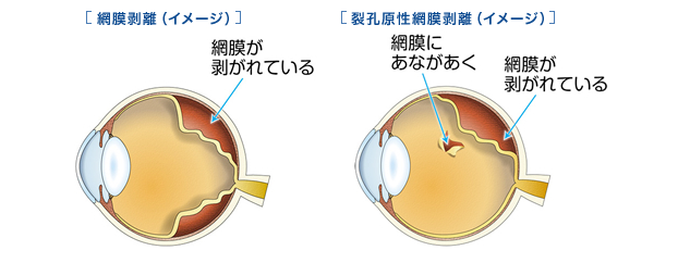 イメージ図
